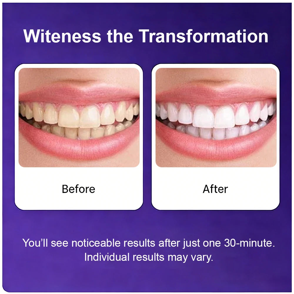 Professional High Viscosity Non Sensitive Teeth Whitening Safe for Enamel Purple V34 Teeth Whitening Strips