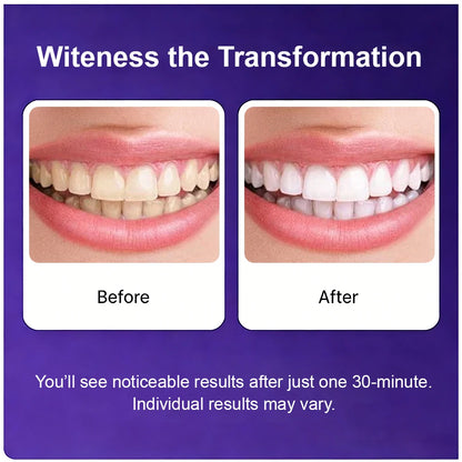 Professional High Viscosity Non Sensitive Teeth Whitening Safe for Enamel Purple V34 Teeth Whitening Strips