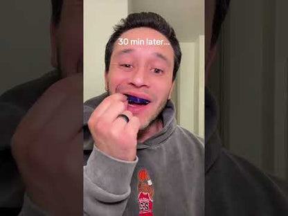 LumiSmile Purple Whitening Strips